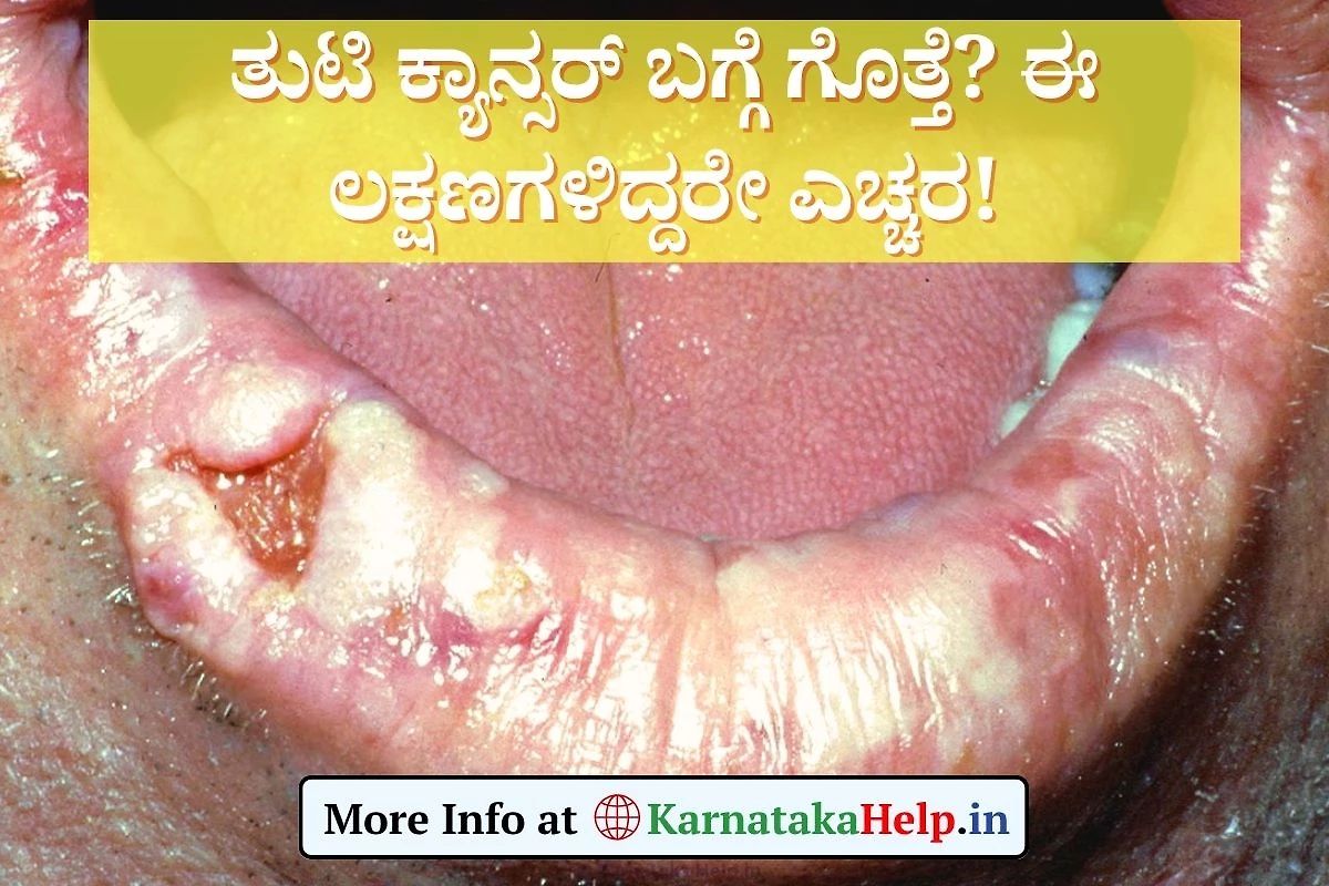 Lip Cancer Symptoms